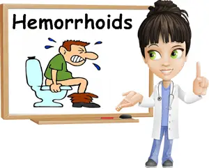 Hemorrhoids