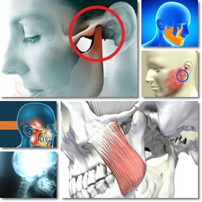 Mandibular pain