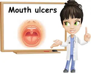 Mouth ulcers causes