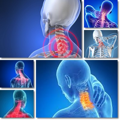 Neck pain