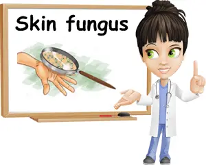 Skin fungus