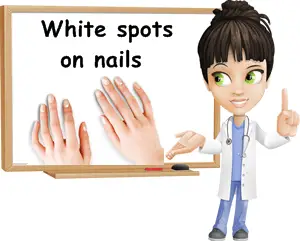 White spots causes