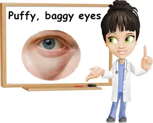 Puffy and baggy eyes