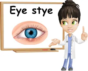 Stye on eyelid