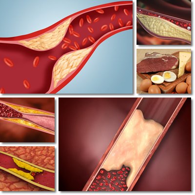 Blood cholesterol