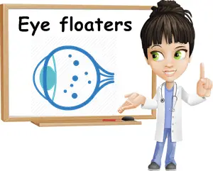 Eye floaters