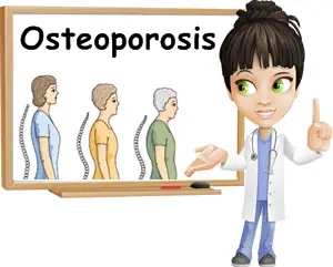 Osteoporosis causes