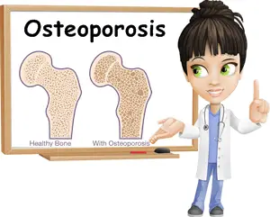 Osteoporosis symptoms