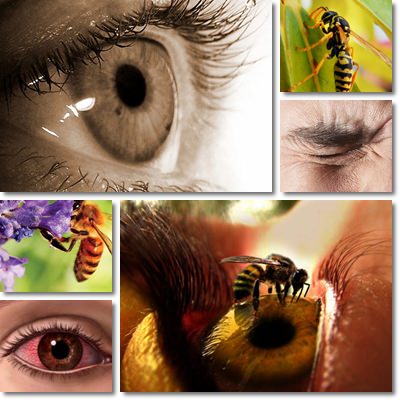 Stinging eyes causes