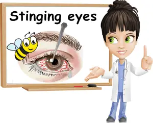 Stinging eyes