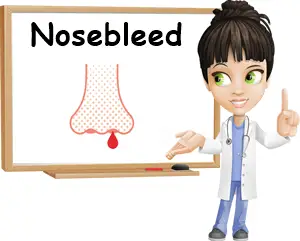 Nosebleed causes