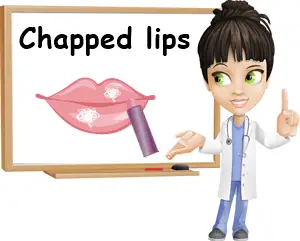 Chapped lips remedies