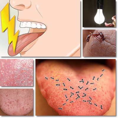 Electric shock sensation in tongue – NatureWord