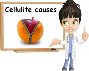 Cellulite causes