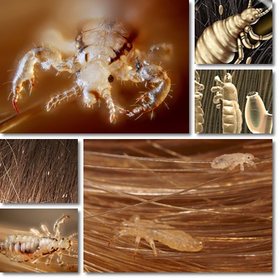 Where Do Head Lice Come From? (Myths and truths) – NatureWord