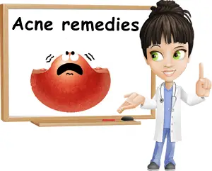 acne remedies