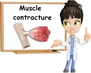 muscle contracture causes