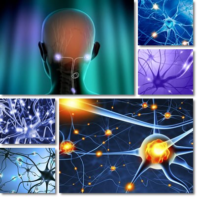 multiple sclerosis