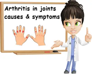 Arthritis in joints causes and symptoms