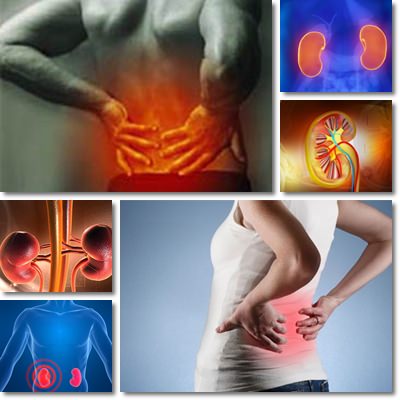 Kidney pain vs back pain
