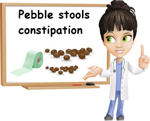 Pebble stools constipation