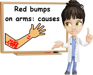 Red bumps on arms causes