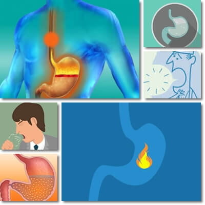 Acid Reflux and Coughing – NatureWord