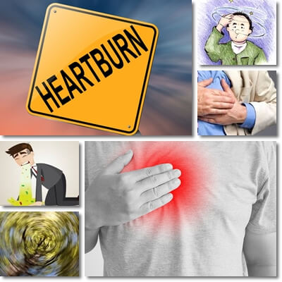 Acid reflux symptoms