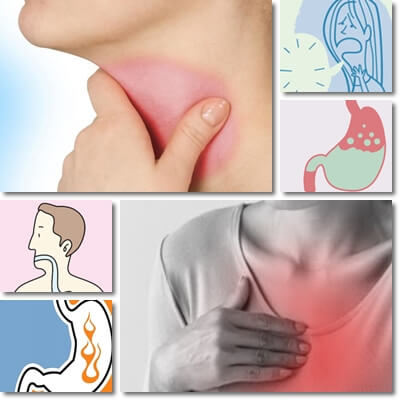 Acid reflux and sore throat treatment