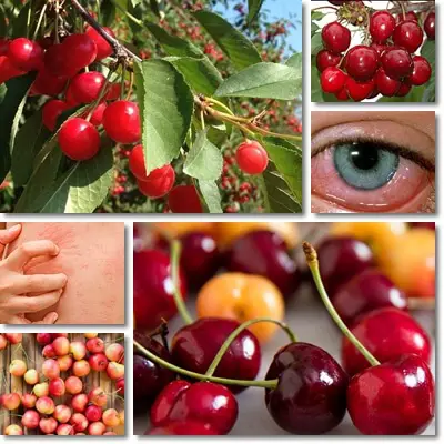 Cherry allergy