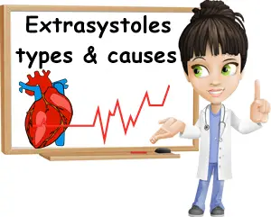 What are extrasystoles